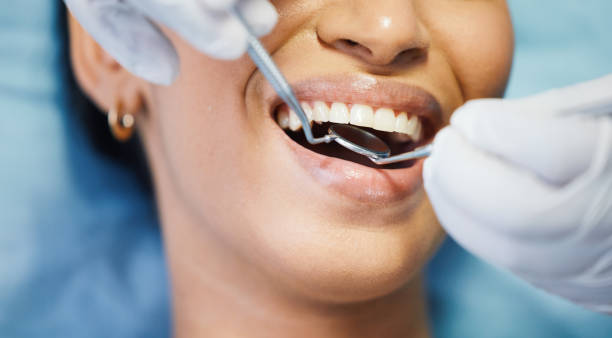 Best Pediatric Emergency Dentist in Saxapahaw, NC