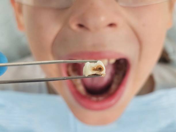 Best Emergency Cosmetic Dentistry in Saxapahaw, NC