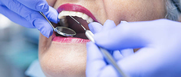 Best Emergency Dental Extractions in Saxapahaw, NC